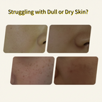 Máscara facial iluminadora e hidratante para correção de manchas.