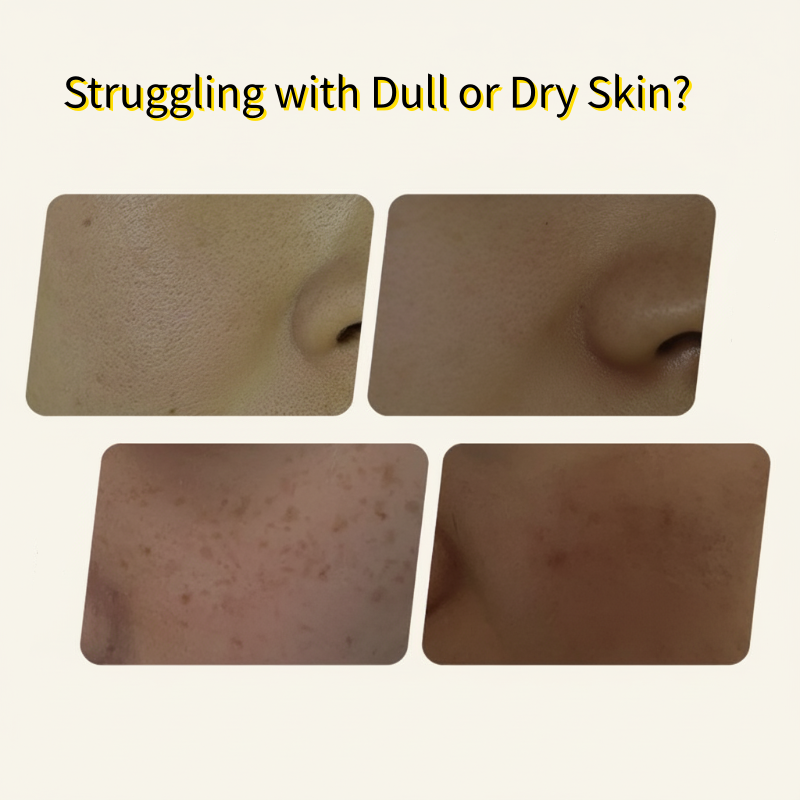 Máscara facial iluminadora e hidratante para correção de manchas.